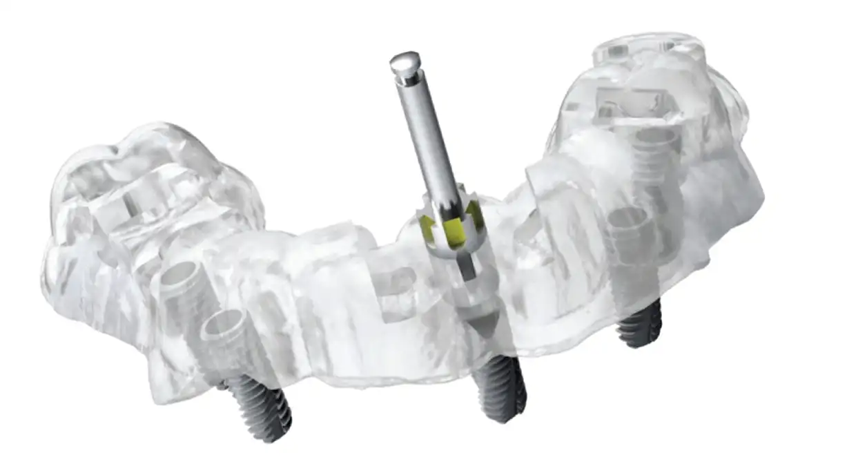 Хирургический шаблон при имплантации ALL-ON-4