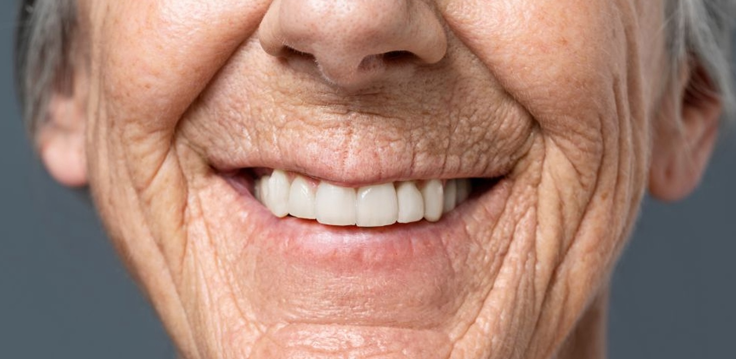 Имплантация ALL-ON-4 в Москве