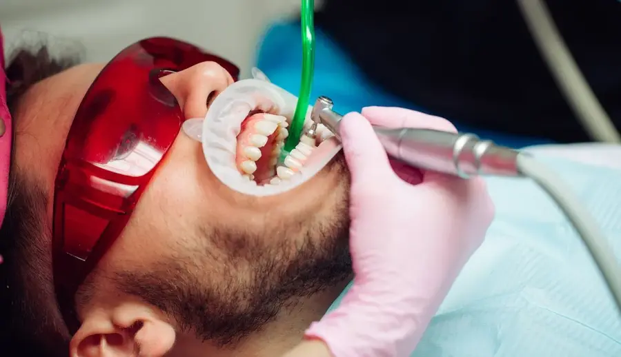 Профессиональная чистка зубов в клинике стомос