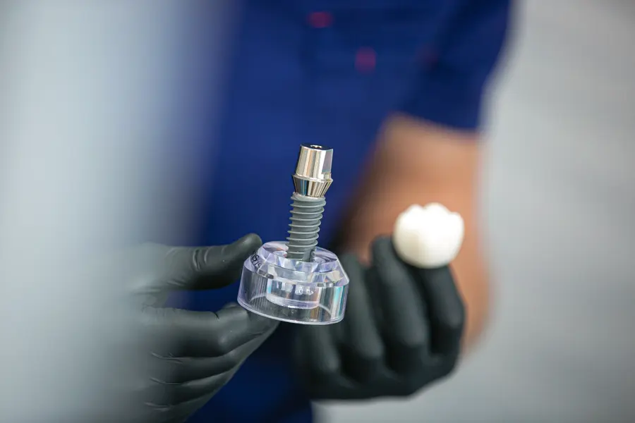 Имплантация и протезирование по скидке в Москве - клиника Стомос