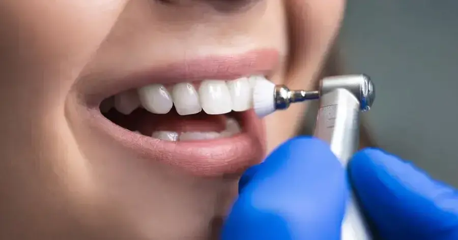 профессиональная чистка зубов в Москве по акции