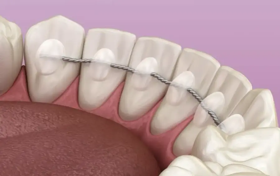 Ретенционный период