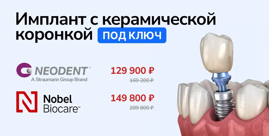 Имплантация зубов. Акция!